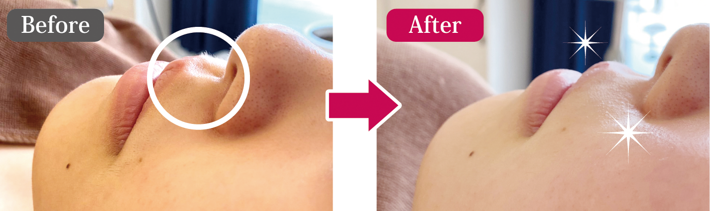 ビフォーアフター1