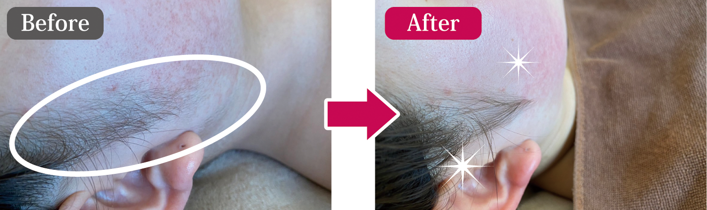 ビフォーアフター2