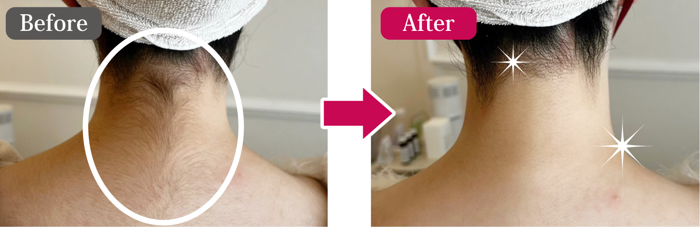 ビフォーアフター3